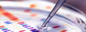 cost gene therapies